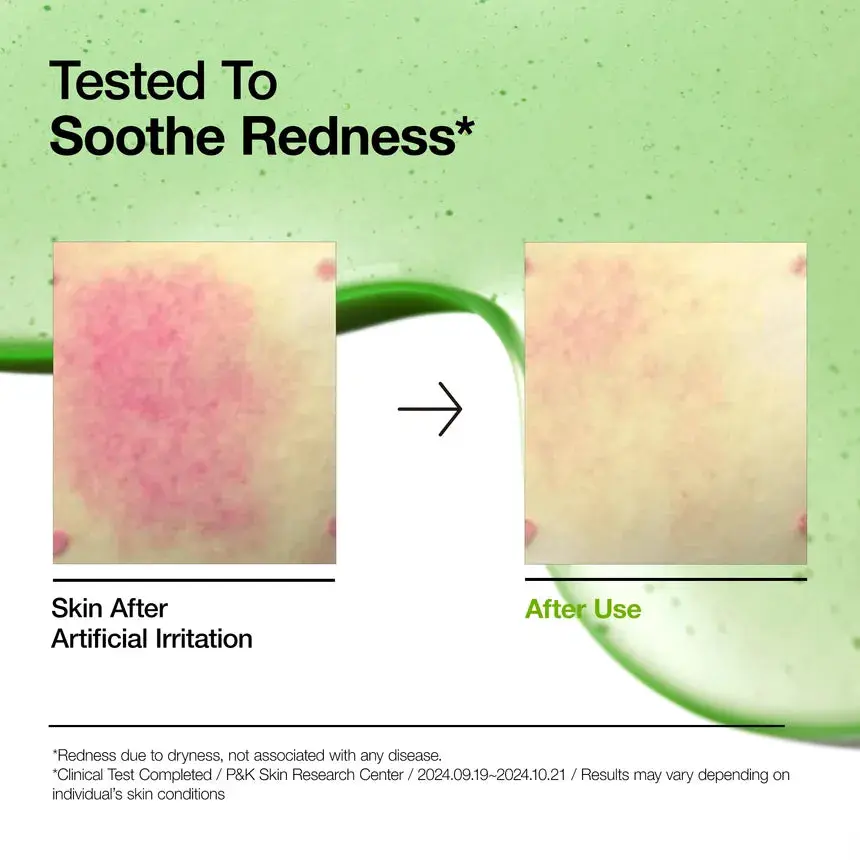 Azelaic Acid 10 Hyaluron Redness Soothing Serum - Image 5