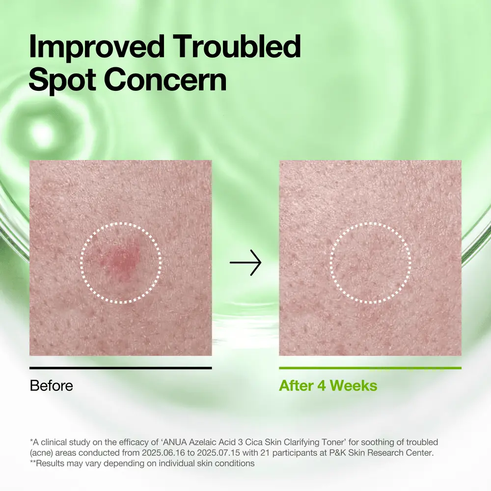 Azelaic Acid 3 Cica Skin Clarifying Toner - Image 3