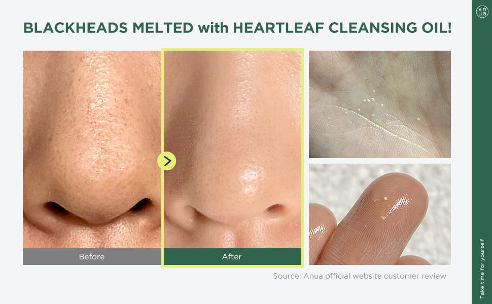 Heartleaf Pore Control Cleansing Oil 20 ml. - Image 3