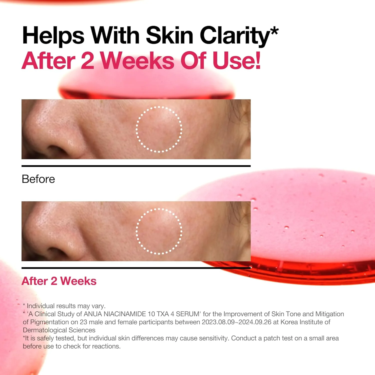 Niacinamide 10% + TXA 4%  Dark Spot Correcting Serum - Image 5