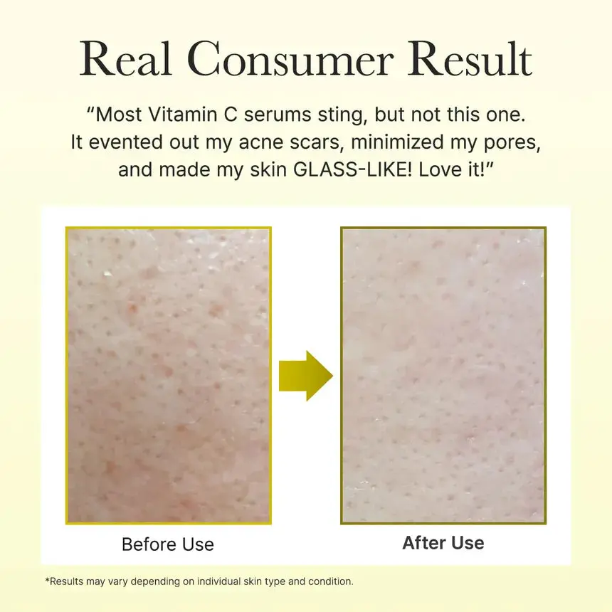 Vitamin C Booster Shot Mini - Image 2
