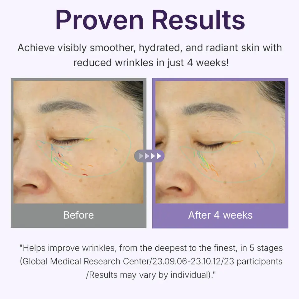 360º Shot PDRN Active Serum - Image 4