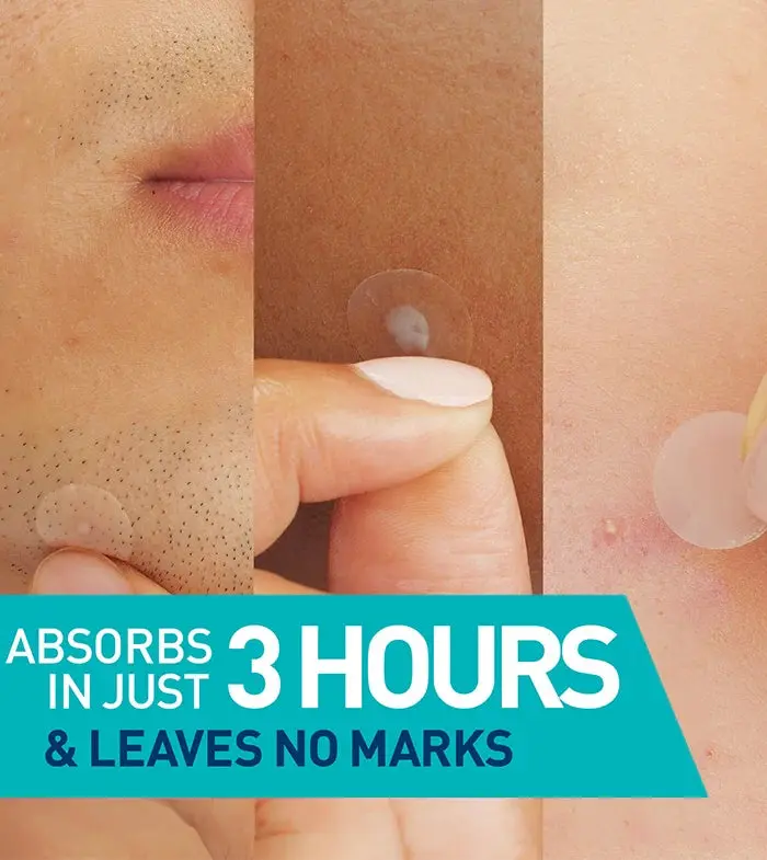 Anti-Blemish Patches - Image 2