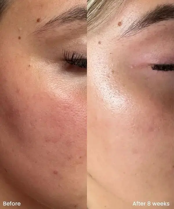 10% Niacinamide Treatment Serum - Image 5