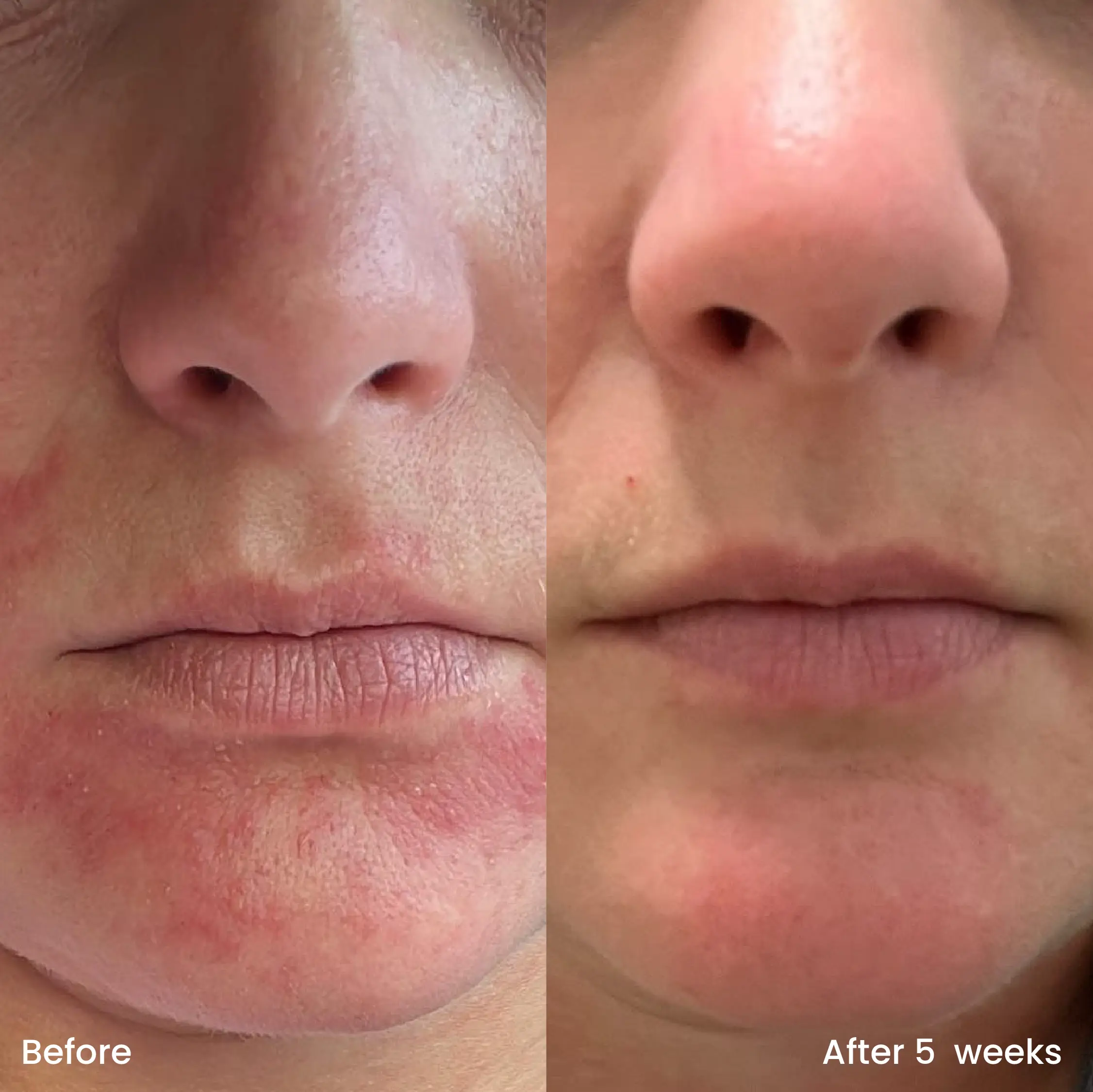 Hydrating Moisturizer - Image 3