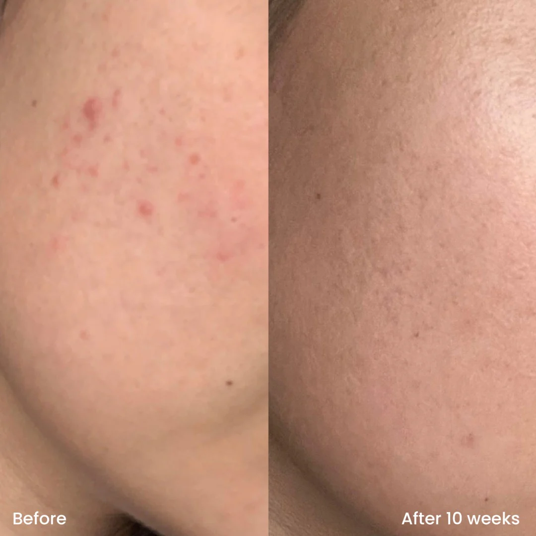 Triple AHA Cleanser - Image 3