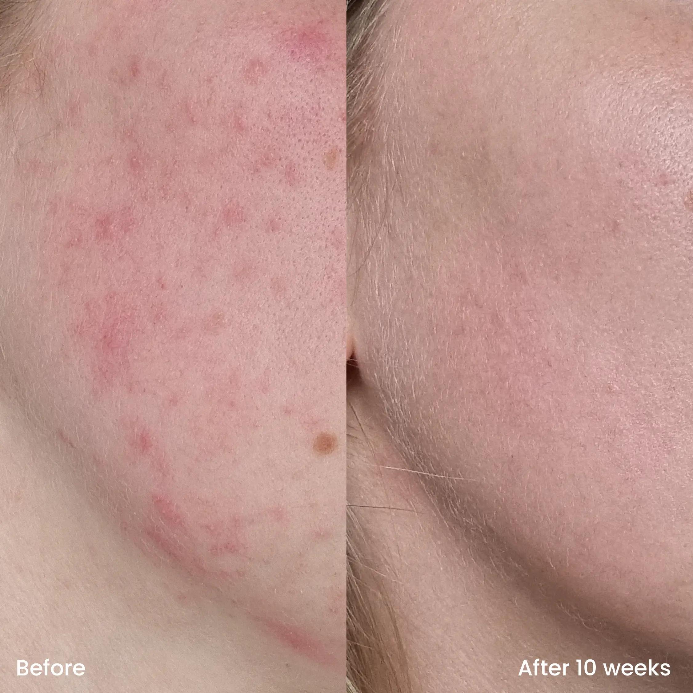 Vitamine C Serum - Image 3