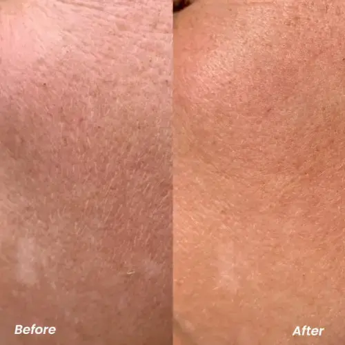 Retinol Pure Night Serum - Image 3