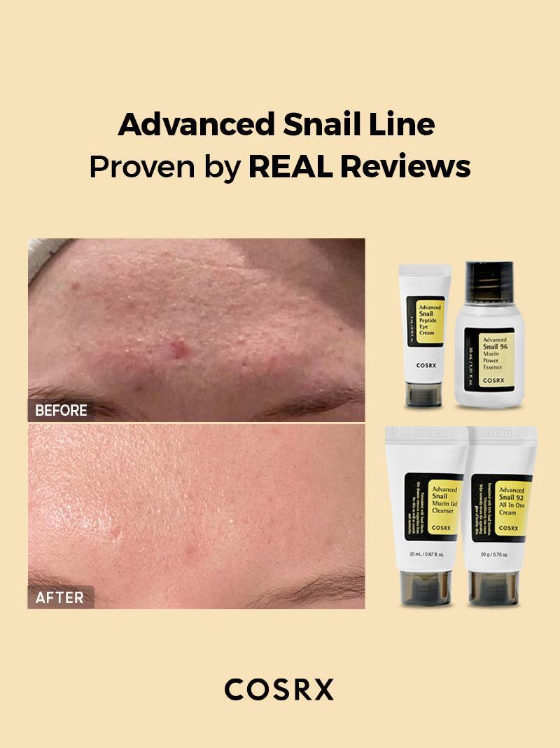All About Advanced Snail Kit - Image 2