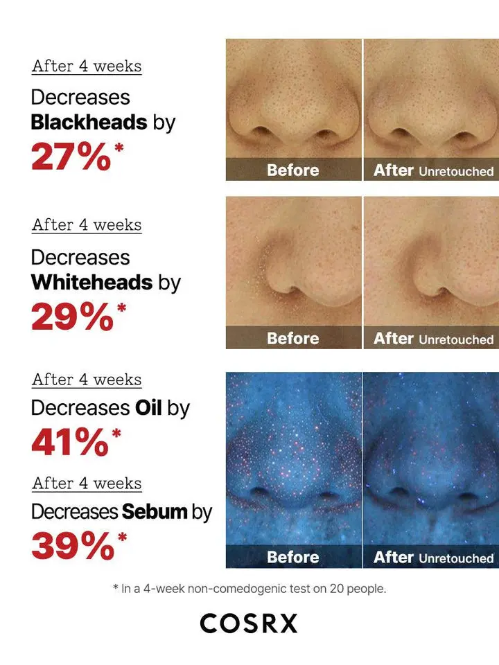 The AHA 2 BHA 2 Blemish Treatment Serum - Image 4