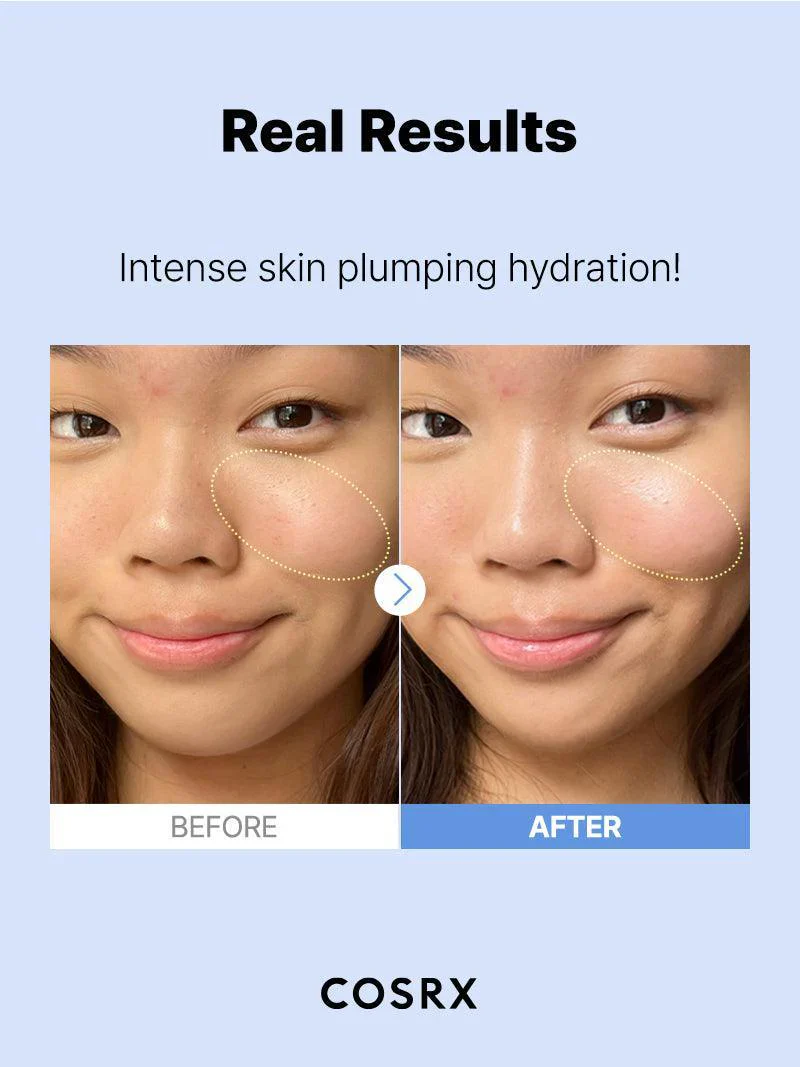 The Hyaluronic Acid 3 Serum - Image 3