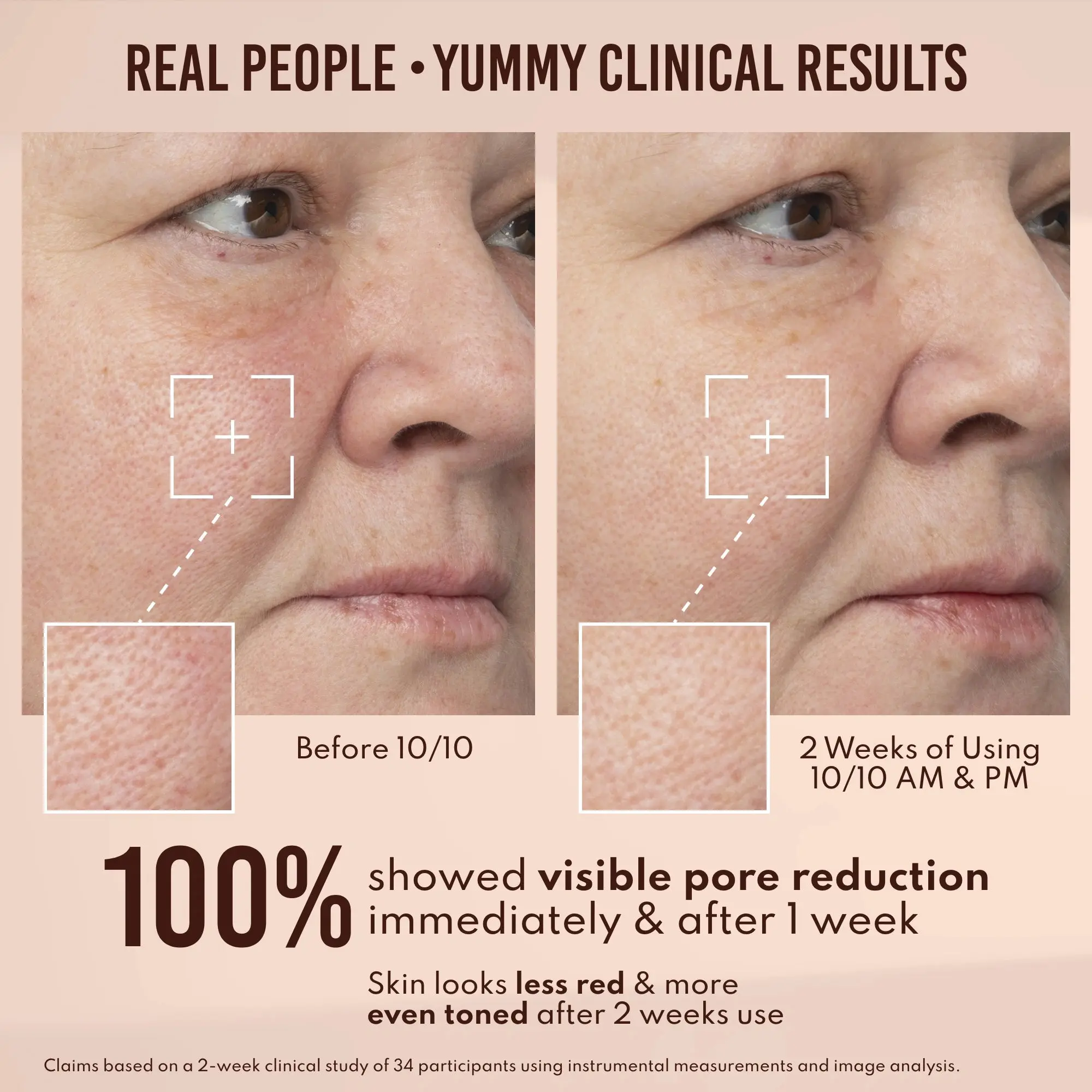 Yummy Skin 10/10 Barrier Boost - Image 4