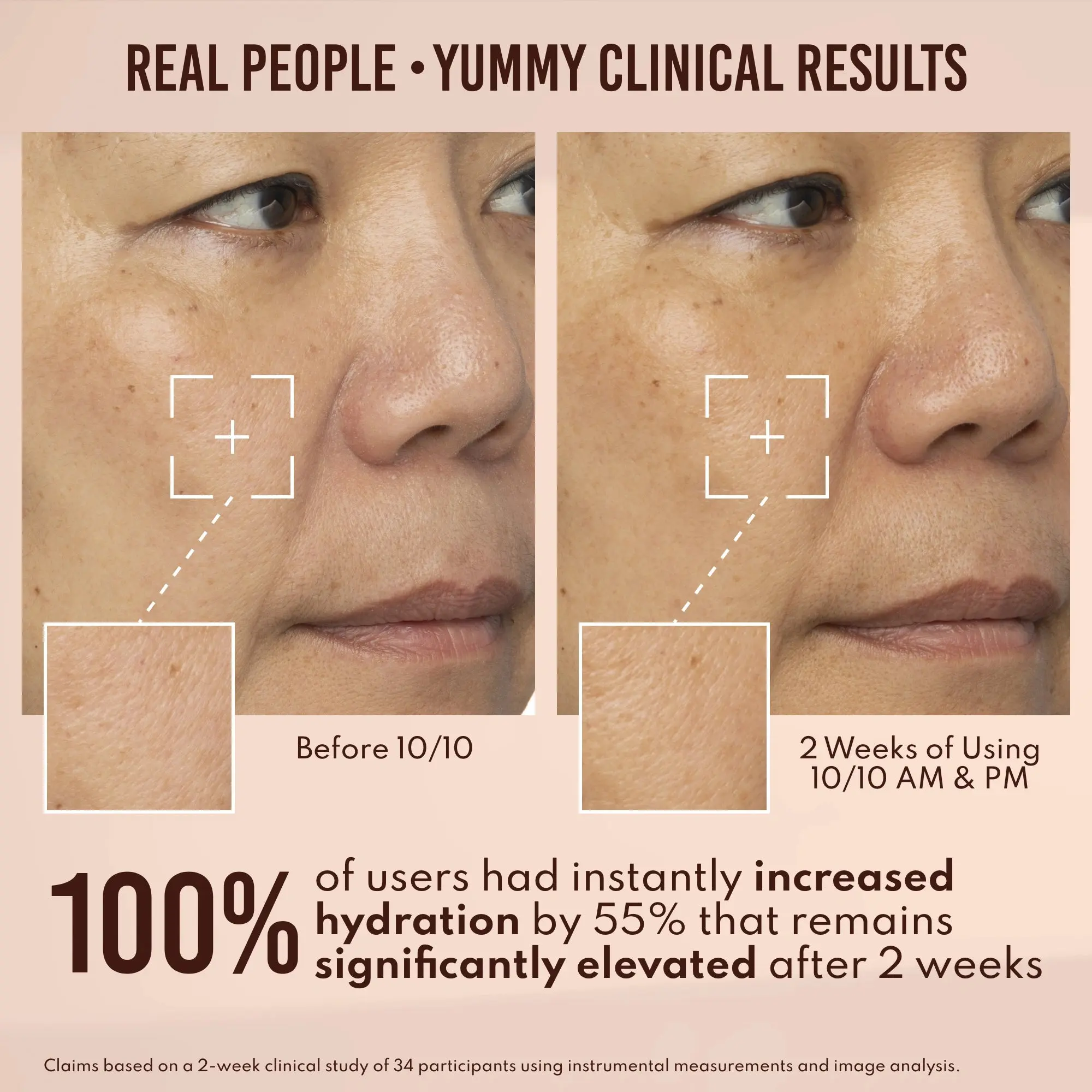 Yummy Skin 10/10 Barrier Boost - Image 5