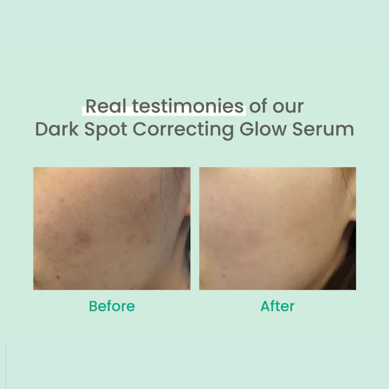 Dark Spot Correcting Glow Serum 20 ml - Image 3