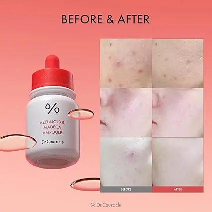 Azelaic 10 & Madeca Ampoule - Image 5