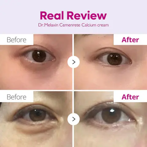 Cemenrete Calcium Intense Cream - Image 2