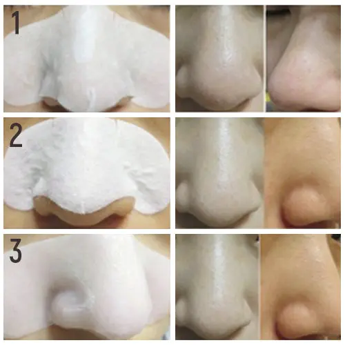Milky Piggy Black Head 3 Step Solution - Image 4