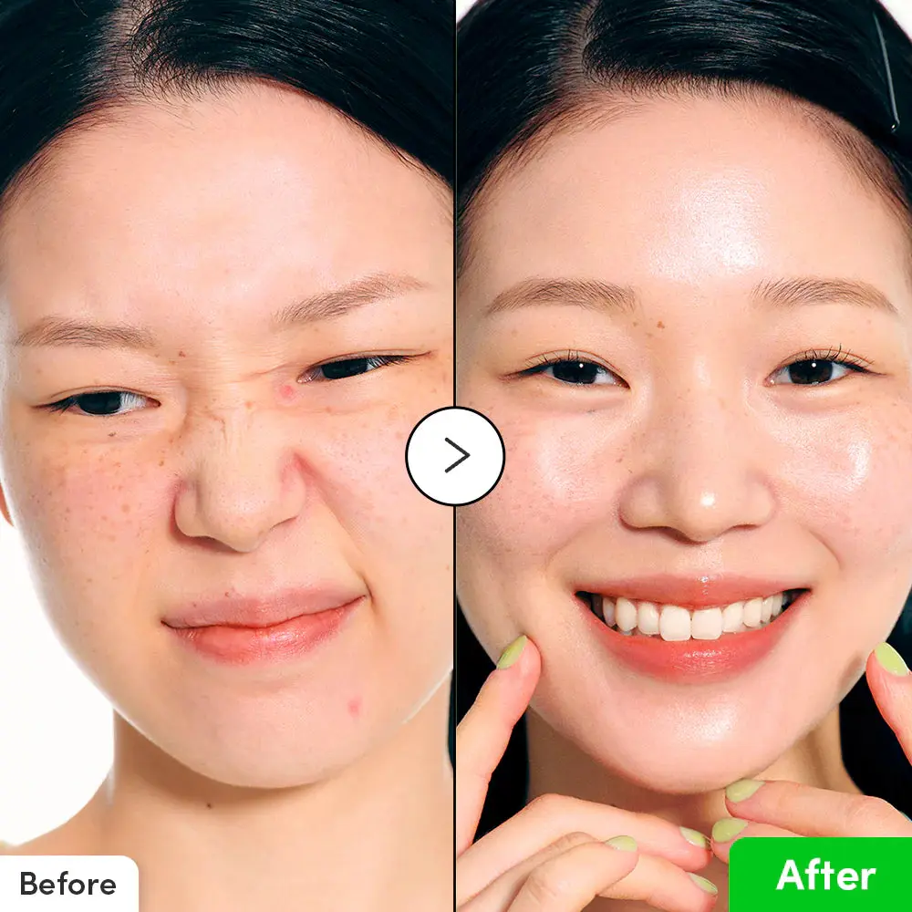 Aloe PDRN Calming Serum - Image 5