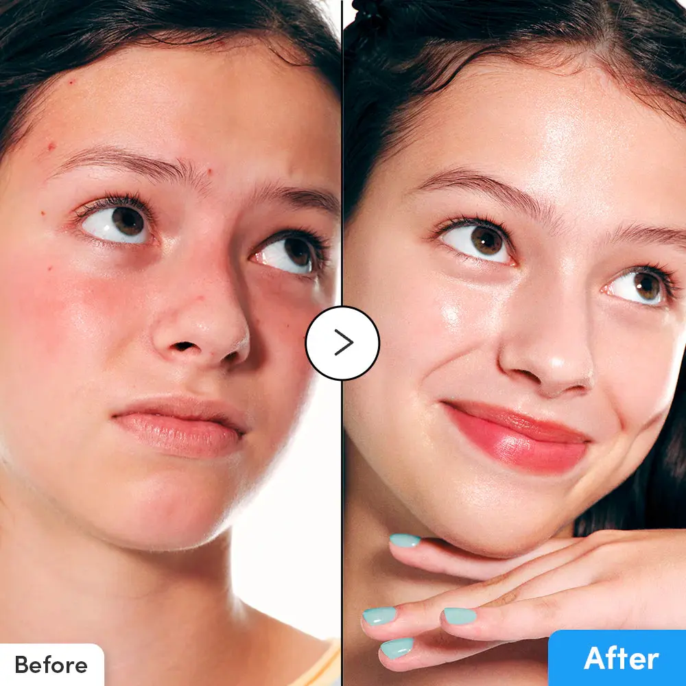 Hyaltoin Flooding Serum - Image 5