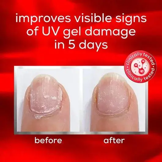 To The Rescue Nail Treatment - Image 3
