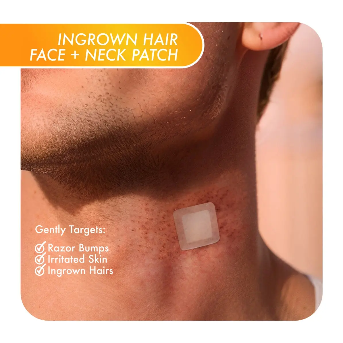 Ingrown Hair Face and Neck Beard Patch - Image 2
