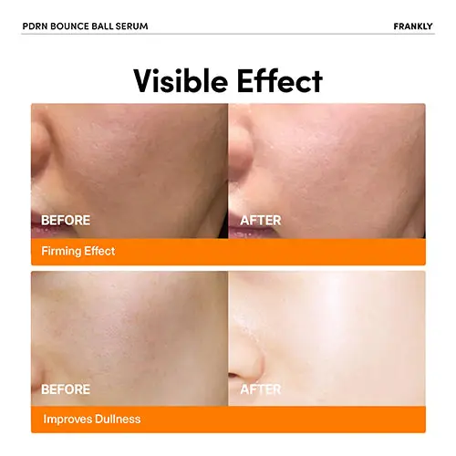 PDRN Bounce Ball Serum - Image 2