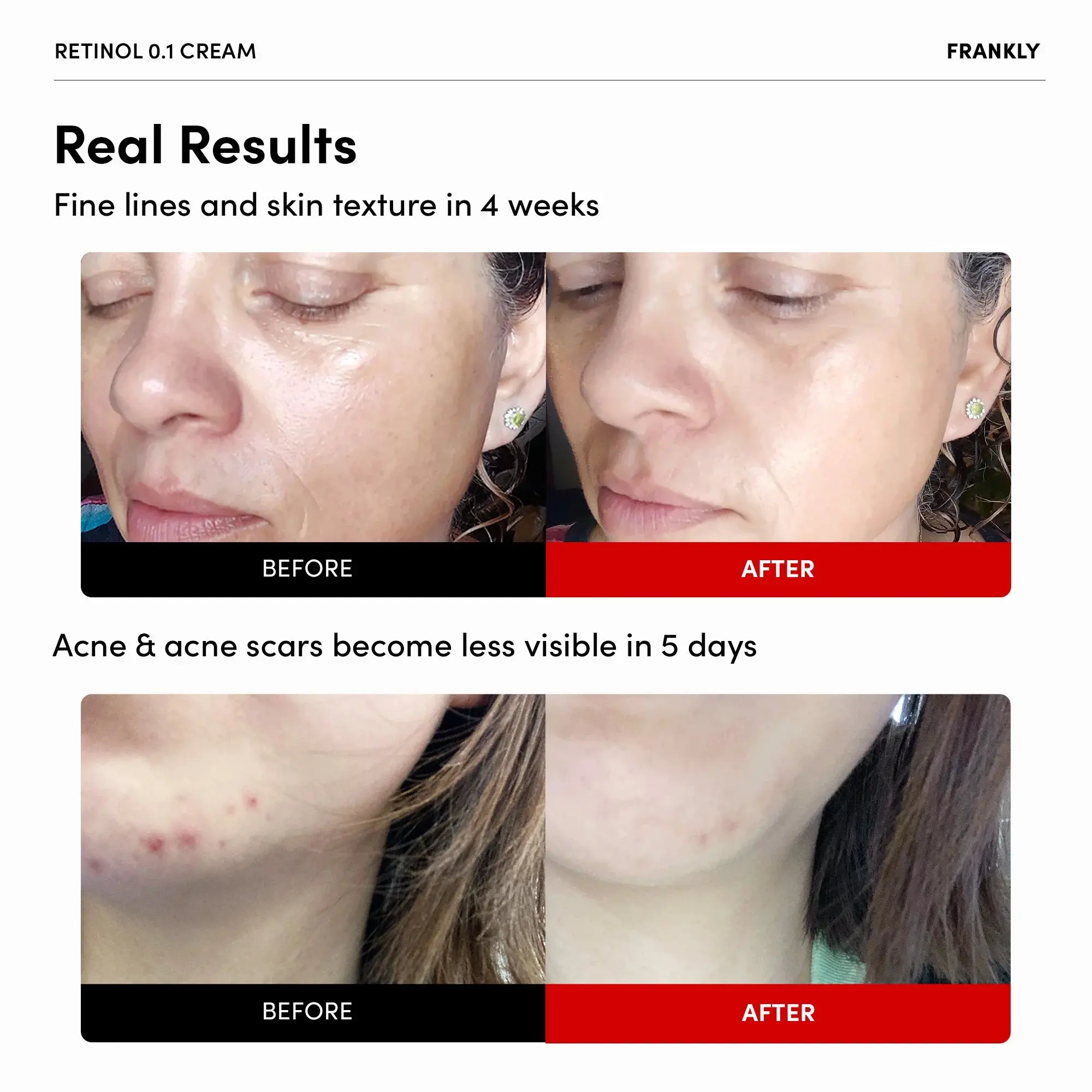 Retinol 0.1% Cream - Image 2