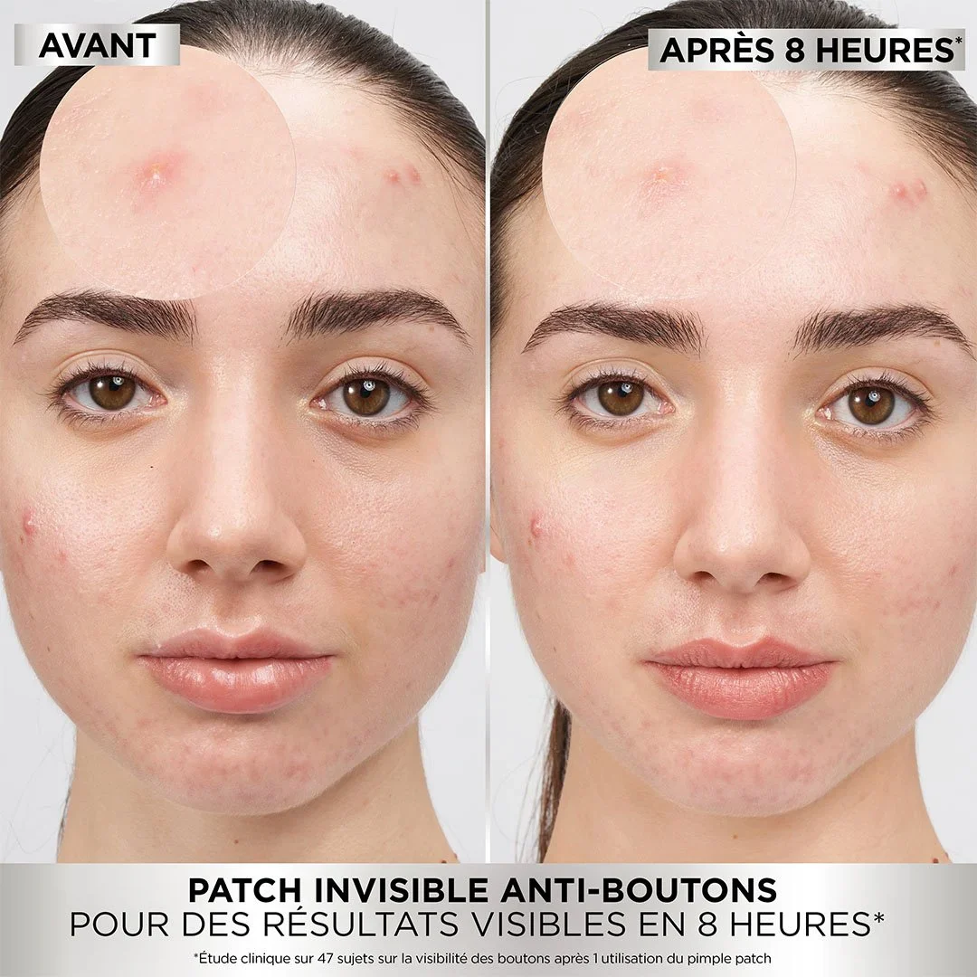 PureActive Pimple Patch - Image 2