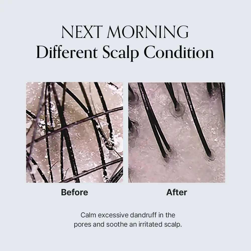 Damage Therapy Scalp Scaling Ampoule - Image 3