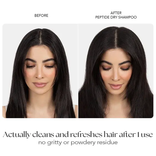 Dry Shampoo - Image 3