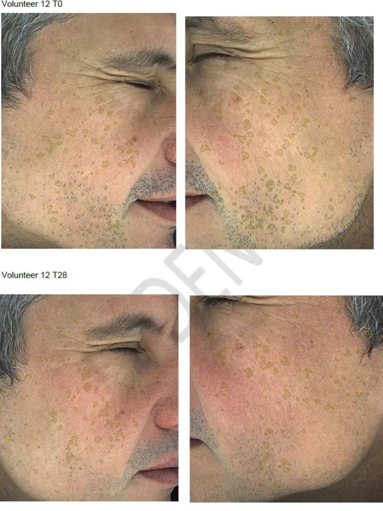 Hyperpigmentation Serum - 2% Alpha Arbutin + 1% Kojic Acid - Image 3