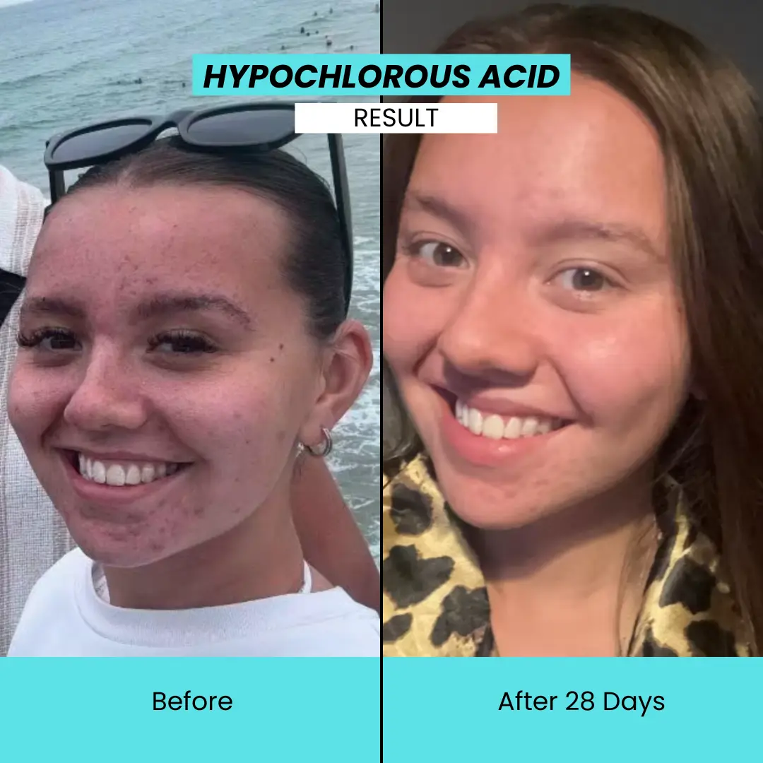 Hypochlorous Cleansing Spray - Image 2
