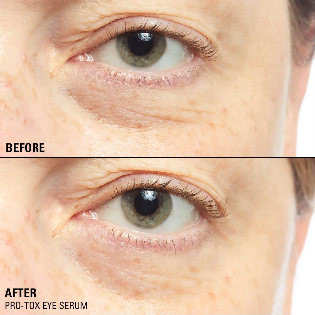 Pro-Tox Instant Fix Eye Firm - Image 5