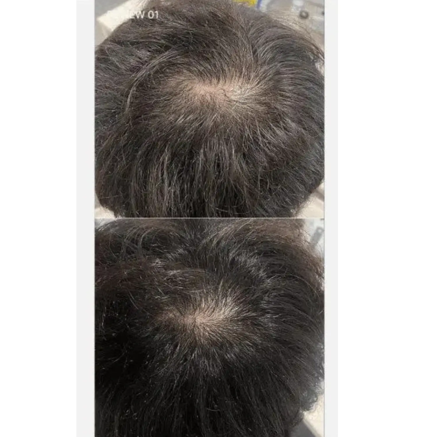 Soyxidil Shampoo - Image 2