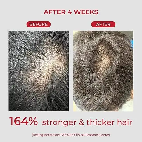 Annurcatin Shampoo - Image 4