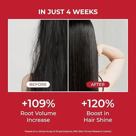 Annurcatin Shampoo - Image 5