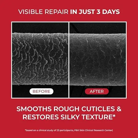 Annurcatin Treatment - Image 4