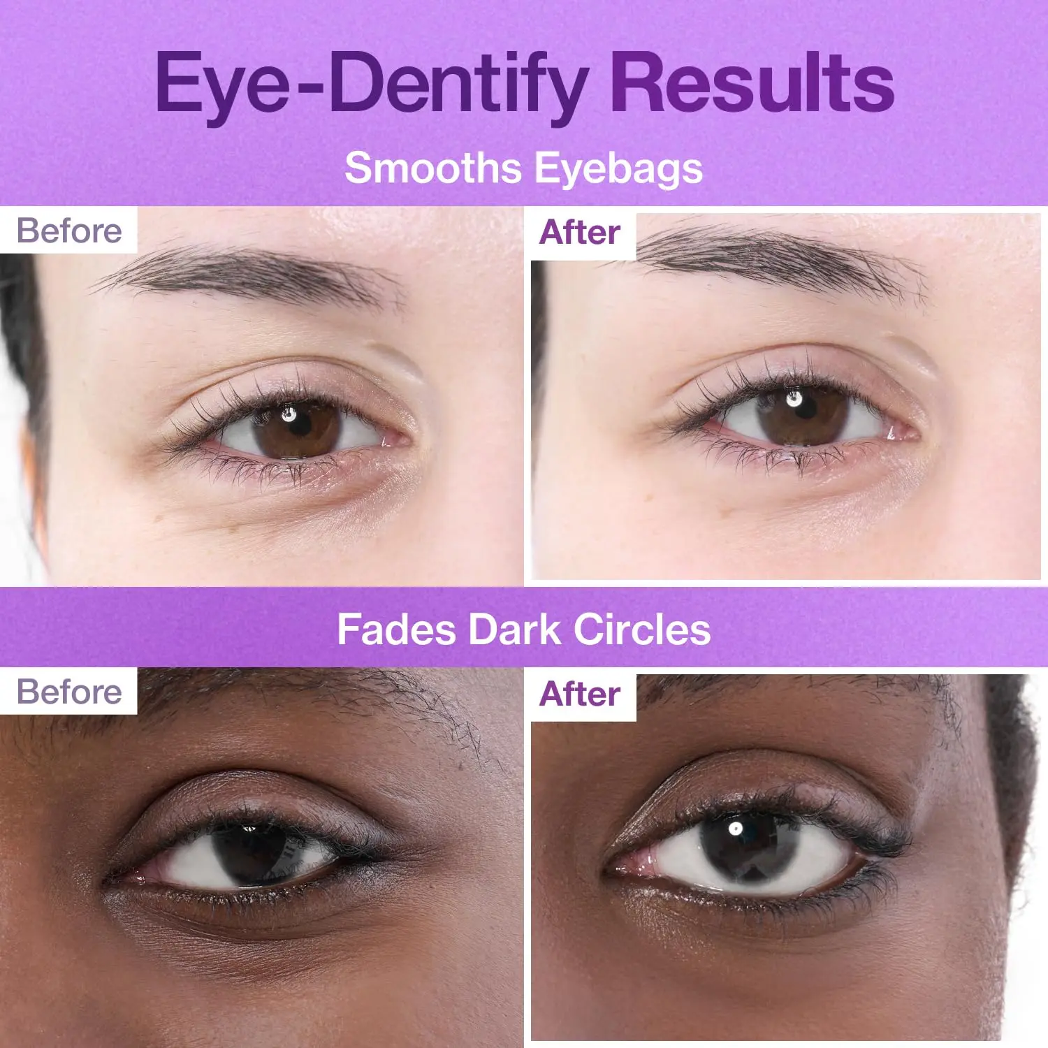 No.9 NAD+ Collagen Under Eye Patches - Image 2