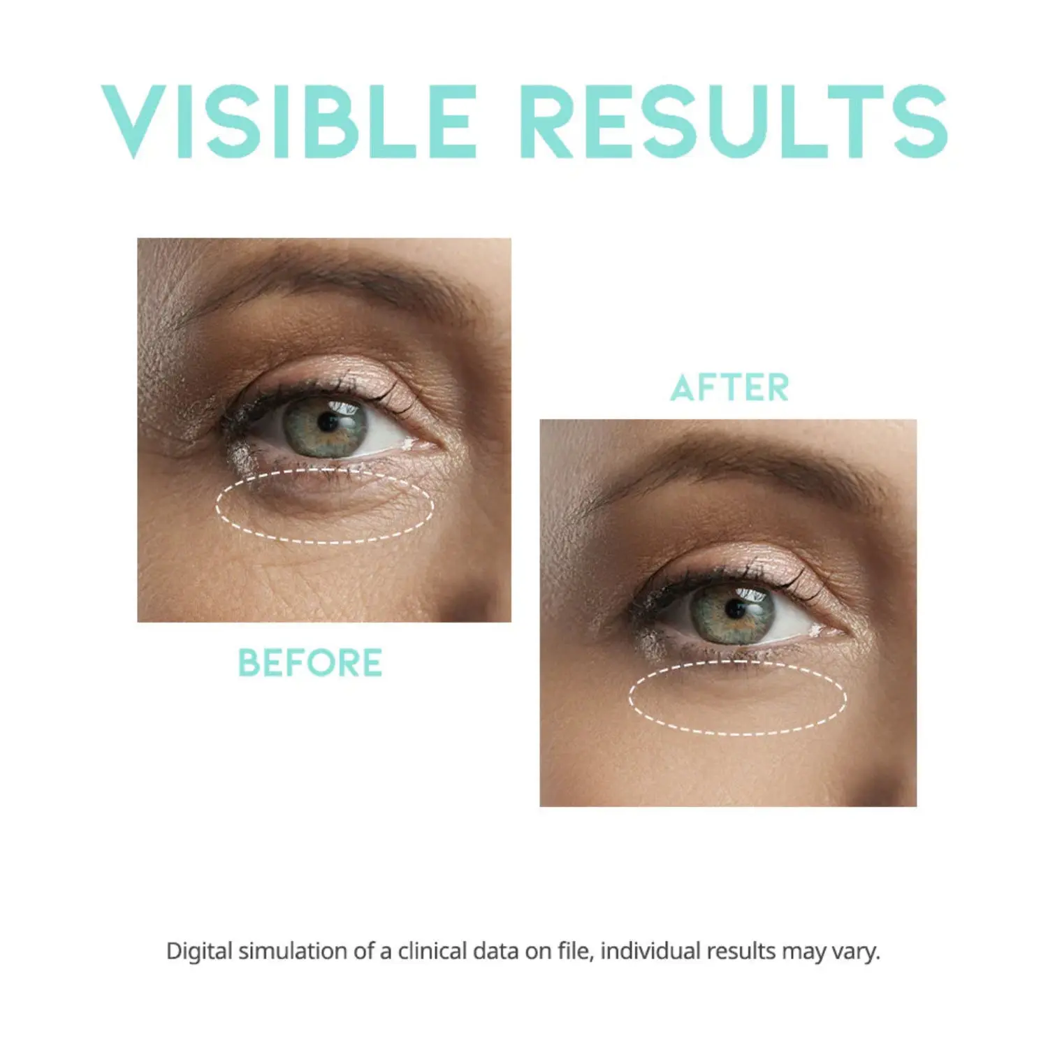 Wrinkle Lift Eye Serum - Image 3
