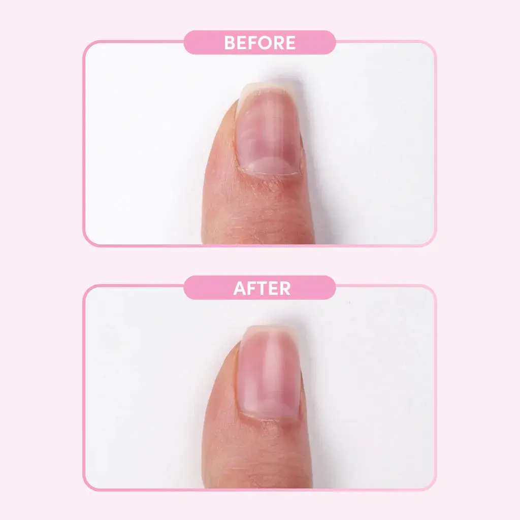 Nail Retouche Smooth + Blur - Image 2