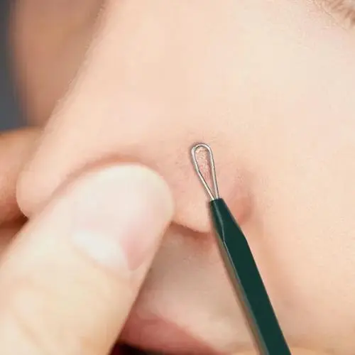 Pimple Extractor Set - Image 2