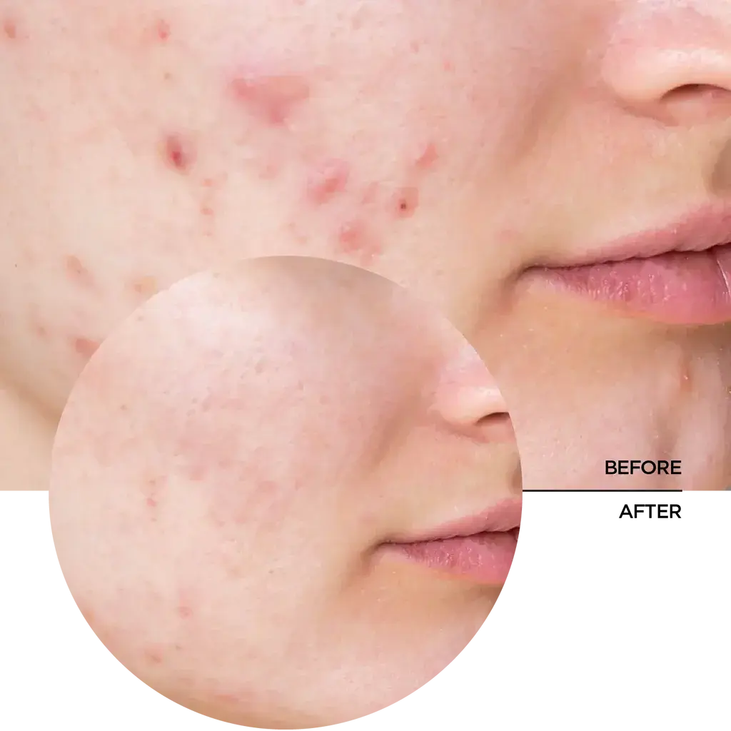 Just Niacinamide 10% - Image 3