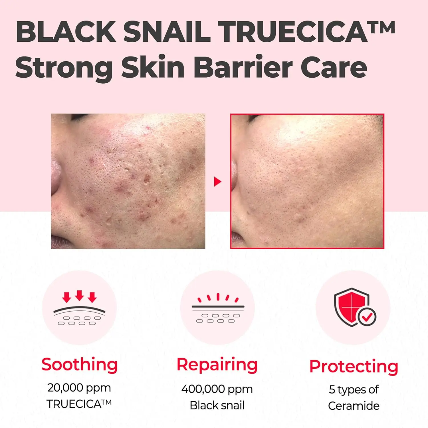 Snail Truecica Miracle Repair Cream - Image 2