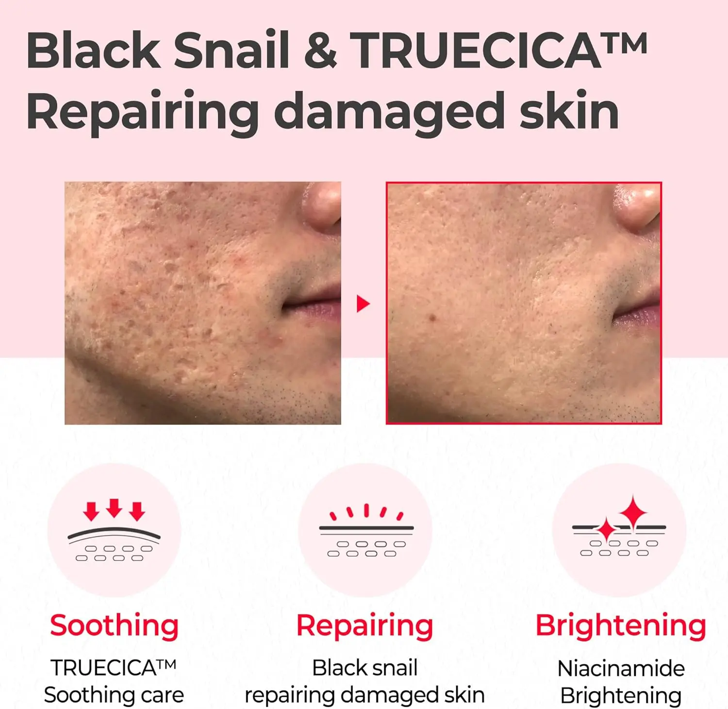 Snail Truecica Miracle Repair Toner - Image 2