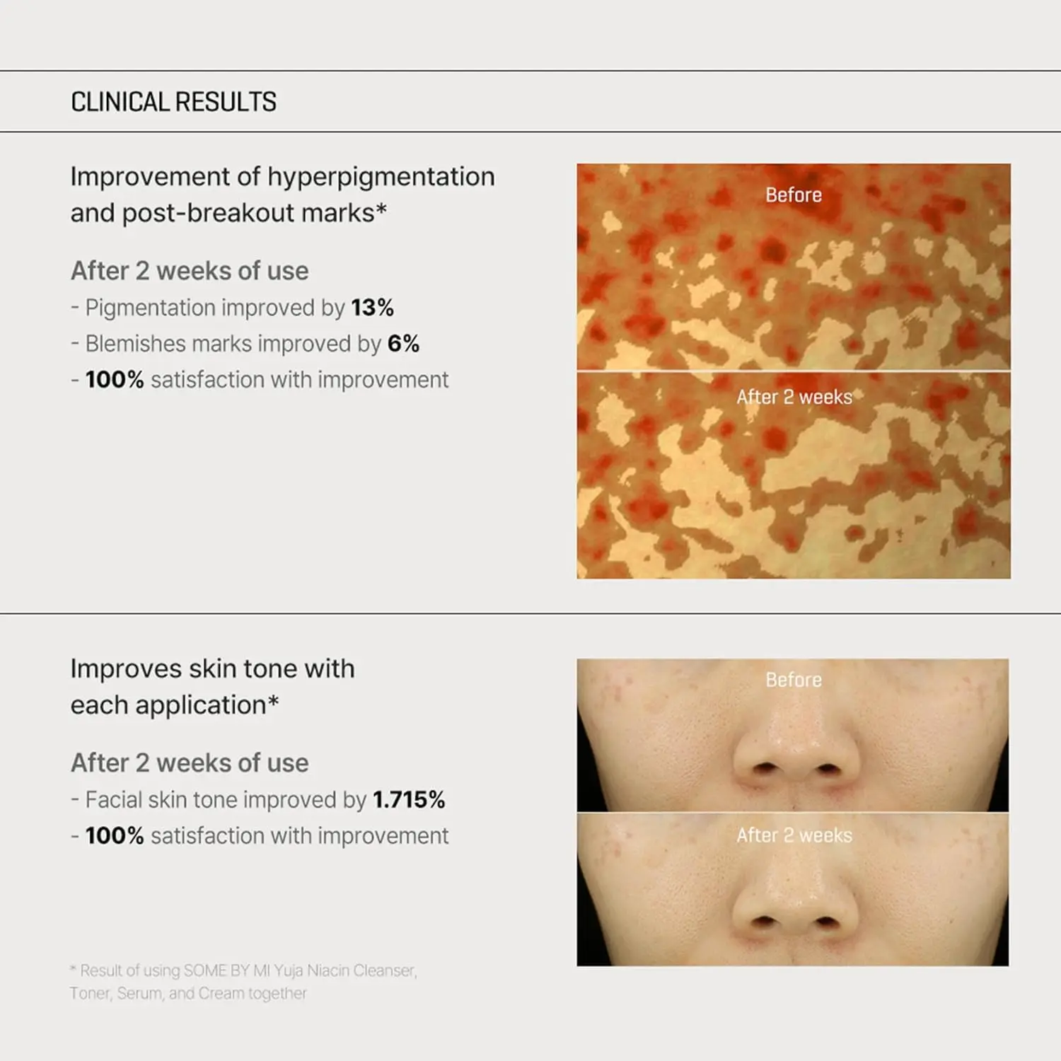Yuja Niacin Anti-Blemish Cream - Image 6