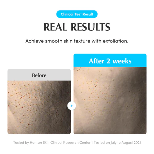 Swimming Pool Daily Facial Toner - Image 8