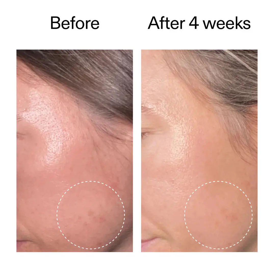 Advanced Retinoid Serum - Image 2