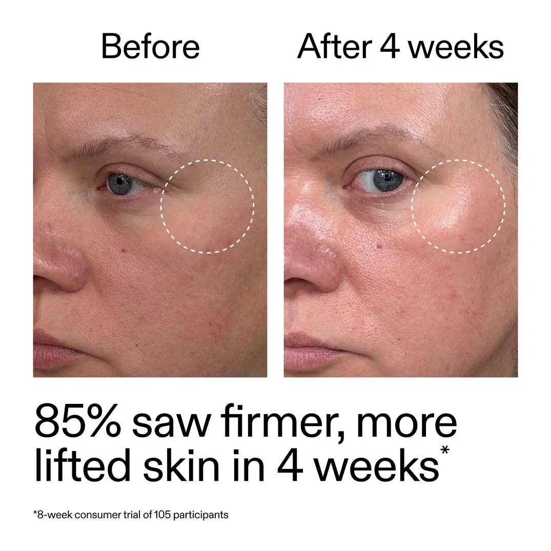 Advanced Retinoid Serum - Image 4