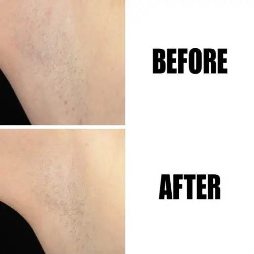 Glycolic Acid Exfoliating Body Stick - Image 5