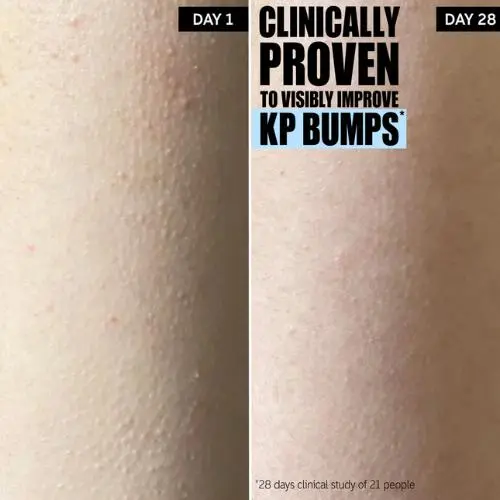 Glycolic Acid Exfoliating Body Stick - Image 6